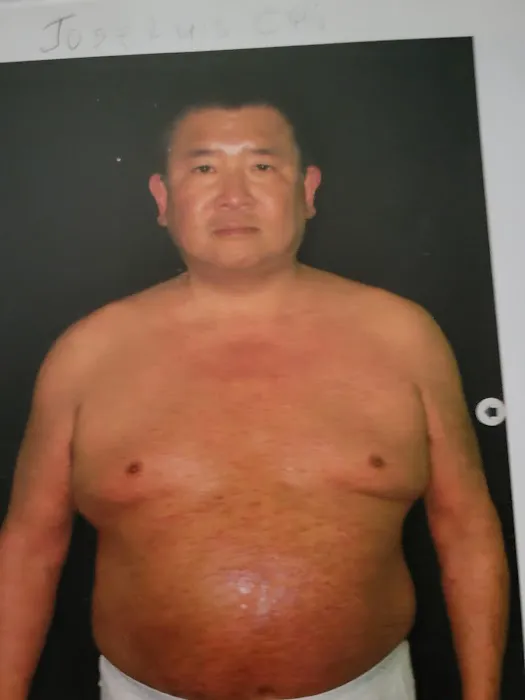 Cure psoriasis Picture 2