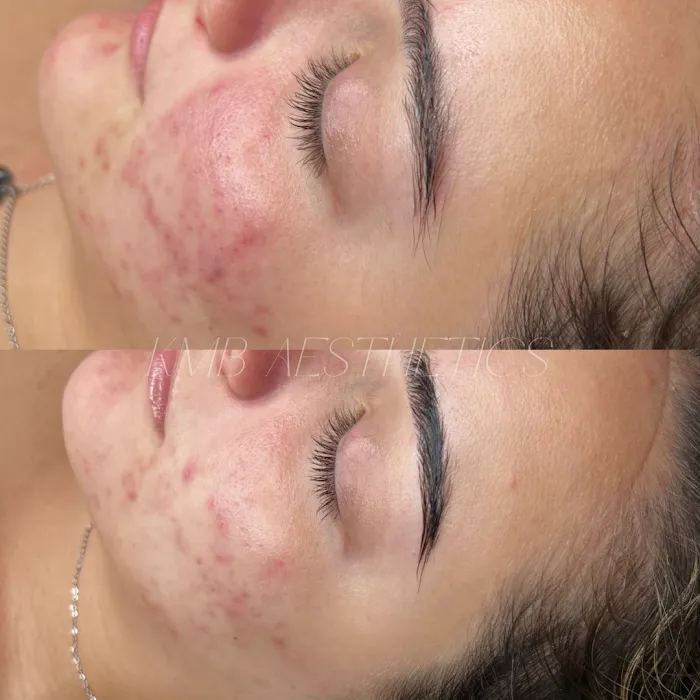 KMB Aesthetic LLC Picture 10