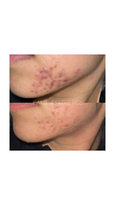 KMB Aesthetic LLC Picture 8