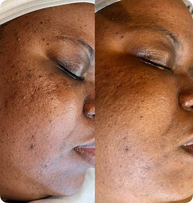 Beaujistic Spa Services Picture 5