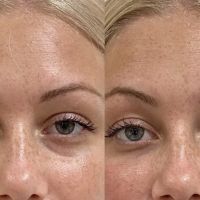 Bajwa Aesthetics ico