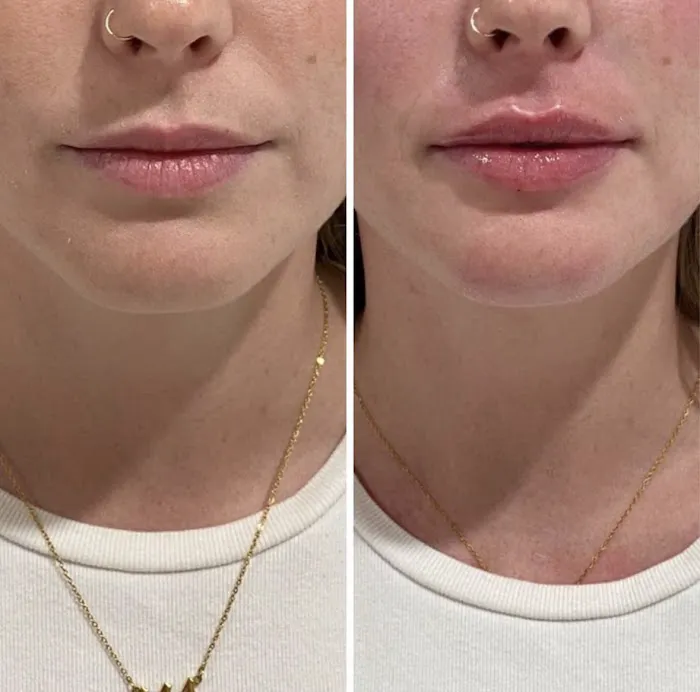 Bajwa Aesthetics Picture 6