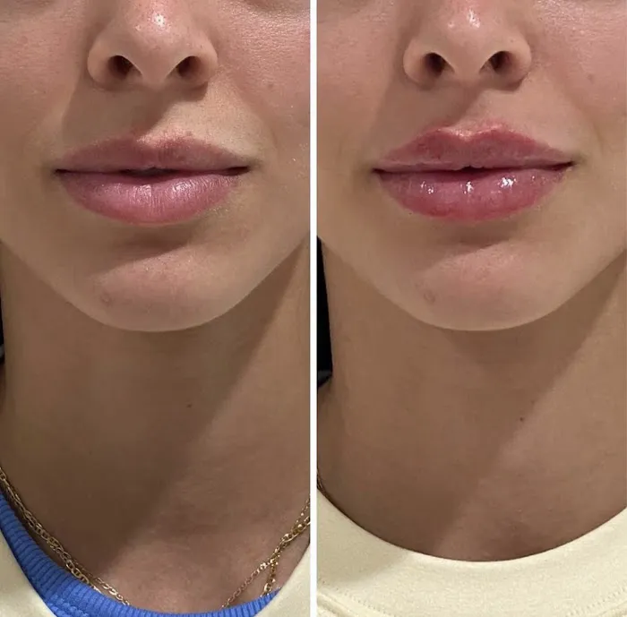 Bajwa Aesthetics Picture 3