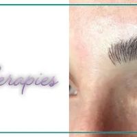 Royalty Therapies ico