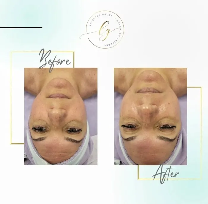 LG Advanced Skin Care, Inc. Picture 2