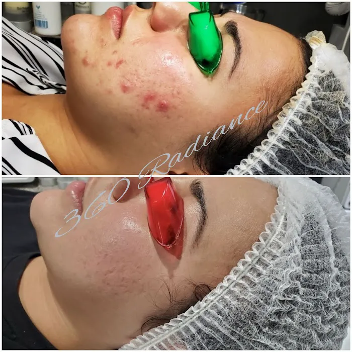 360 Radiance Picture 10