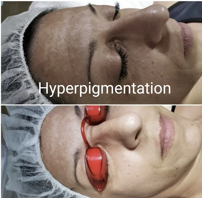 360 Radiance Picture 9