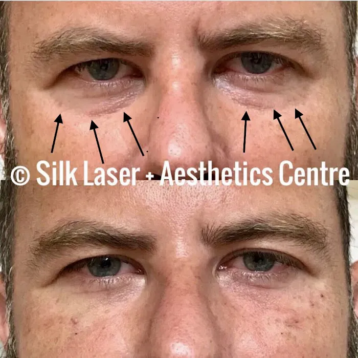 Silk Laser + Aesthetics Centre Picture 4