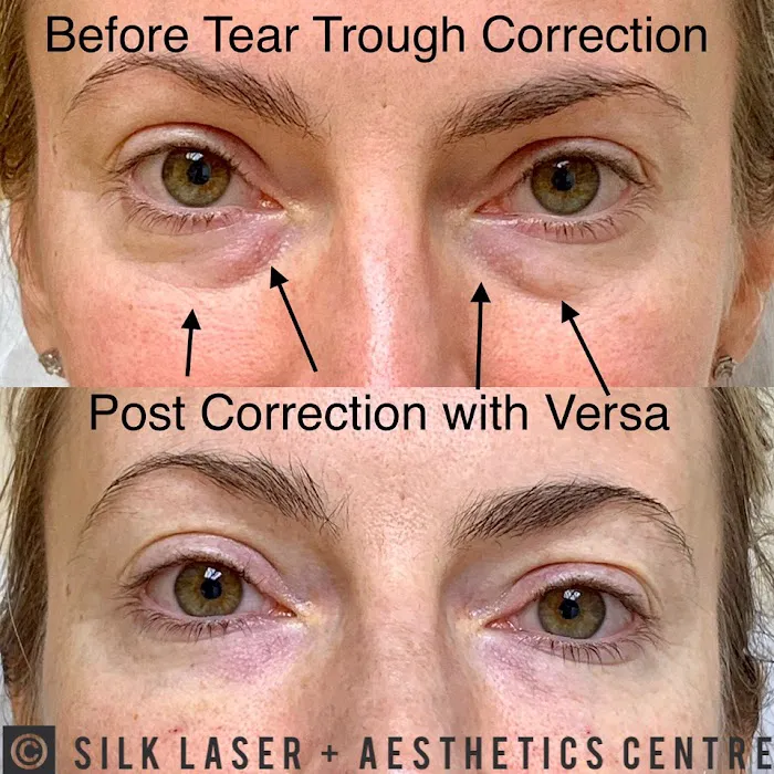 Silk Laser + Aesthetics Centre Picture 7