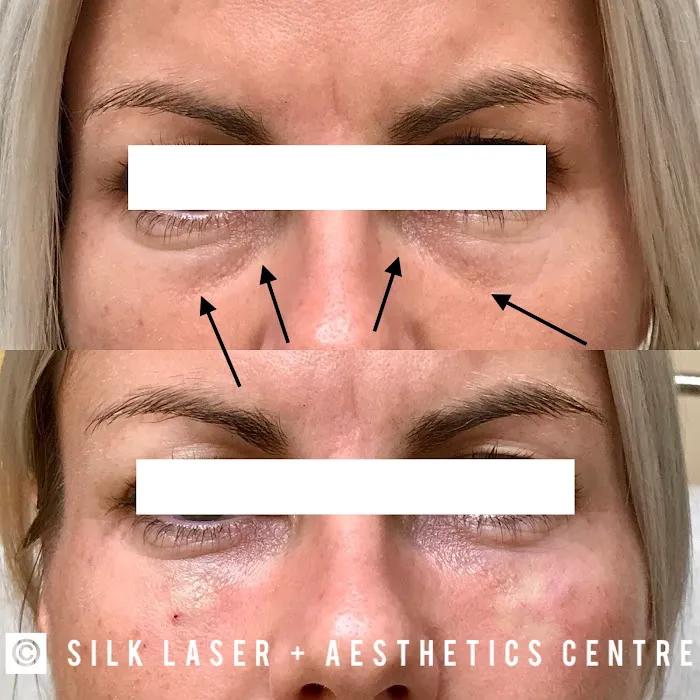 Silk Laser + Aesthetics Centre Picture 2