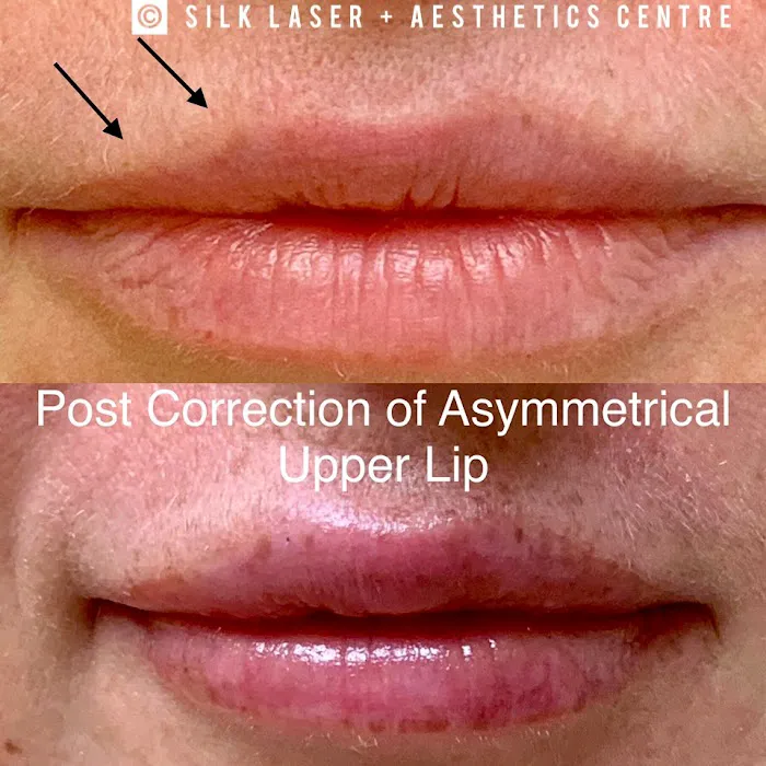 Silk Laser + Aesthetics Centre Picture 9