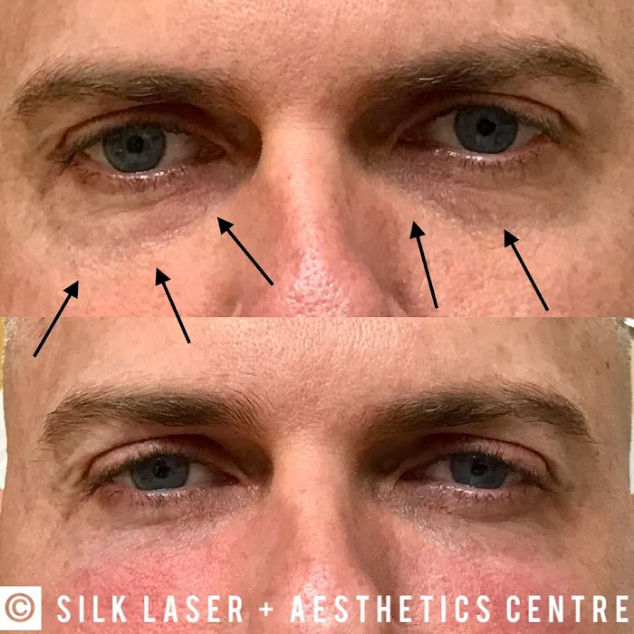 Silk Laser + Aesthetics Centre Picture 8