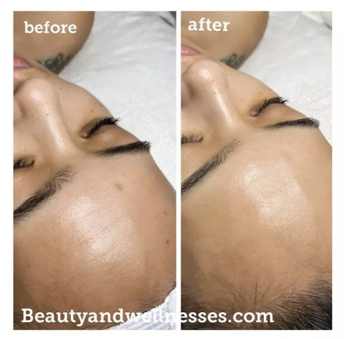 Massage | woman | Soul Massage | Acne | Skin Care | Spiritual Therapy l Beauty and Wellness Picture 8