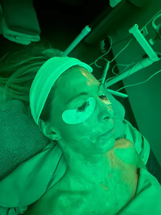 Massage | woman | Soul Massage | Acne | Skin Care | Spiritual Therapy l Beauty and Wellness Picture 2