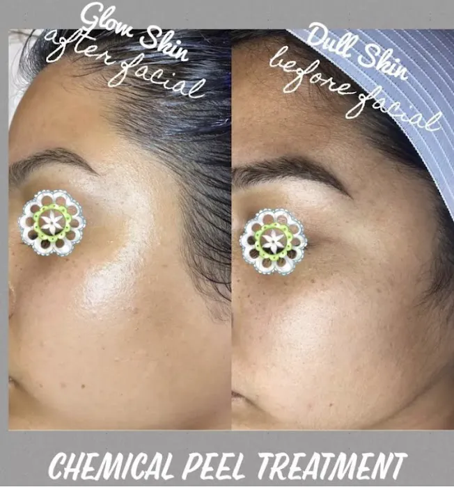 Massage | woman | Soul Massage | Acne | Skin Care | Spiritual Therapy l Beauty and Wellness Picture 10