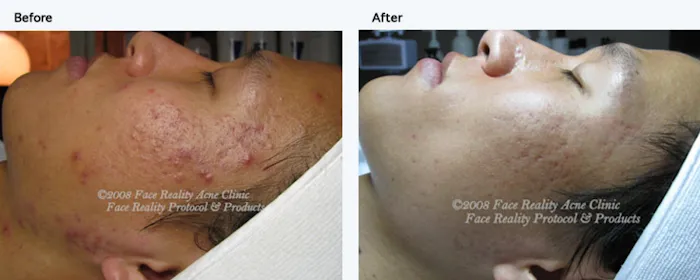 Skin Esteem Picture 10