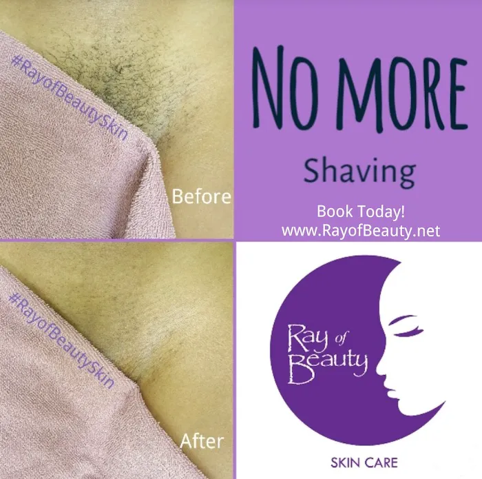 Ray of Beauty Skincare Picture 4