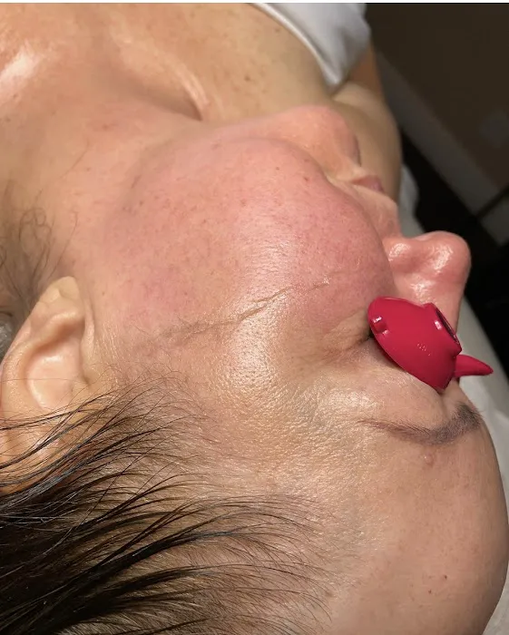 Simply Skin Ft Lauderdale Picture 5