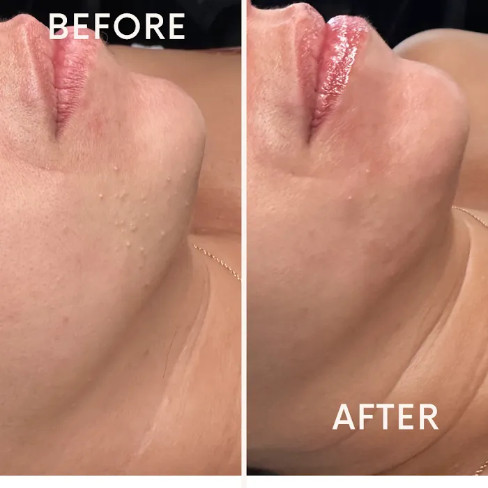 Brianna Victoria Licensed Aesthetician Picture 1