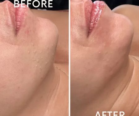 Brianna Victoria Licensed Aesthetician