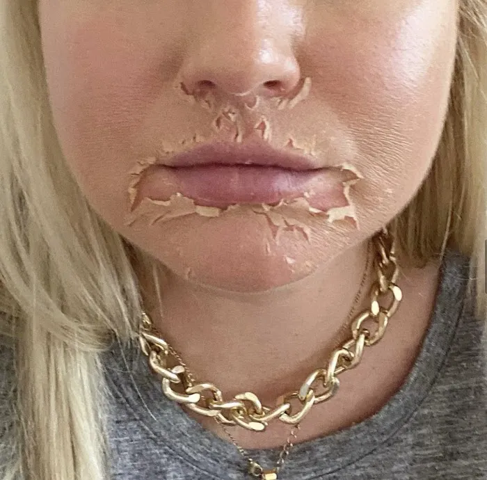 Flawless Skin Care Picture 8