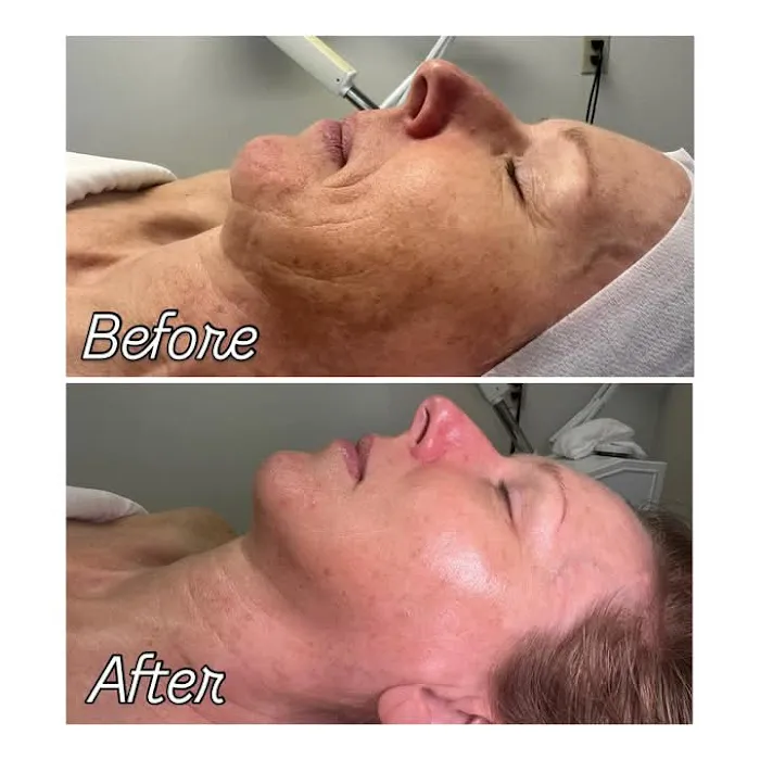 Renew Skincare Picture 9