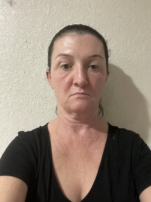 Juvly Aesthetics Picture 9