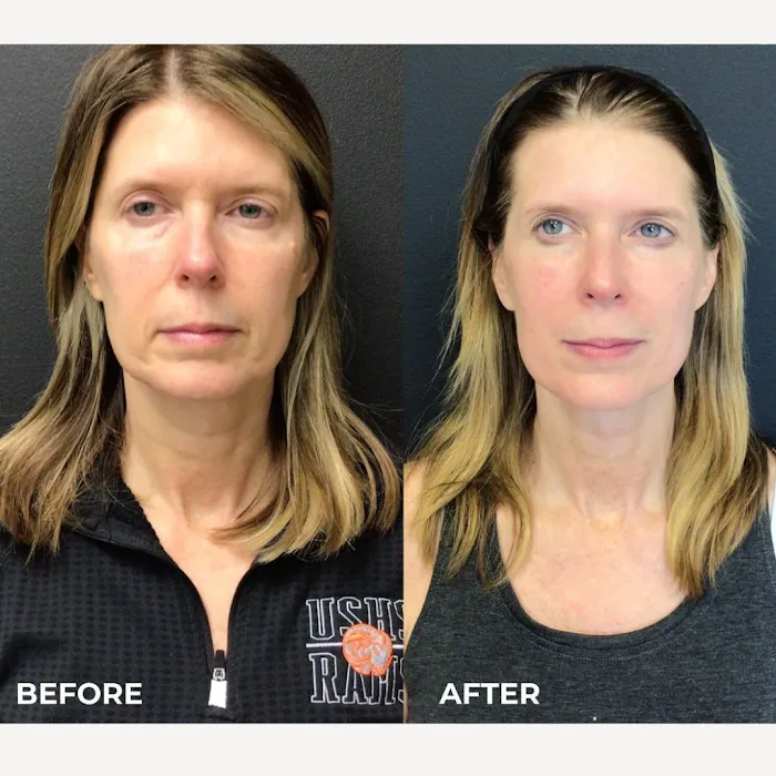 Juvly Aesthetics Picture 10