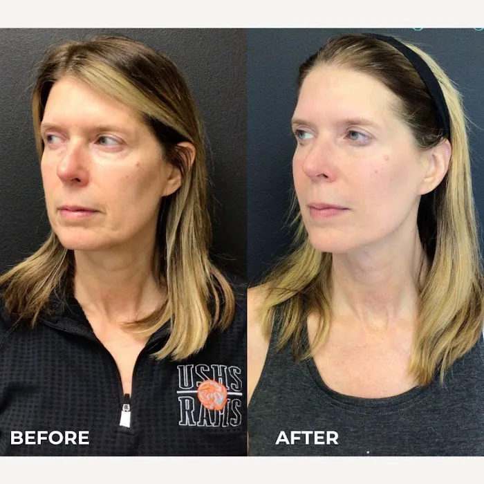 Juvly Aesthetics Picture 7