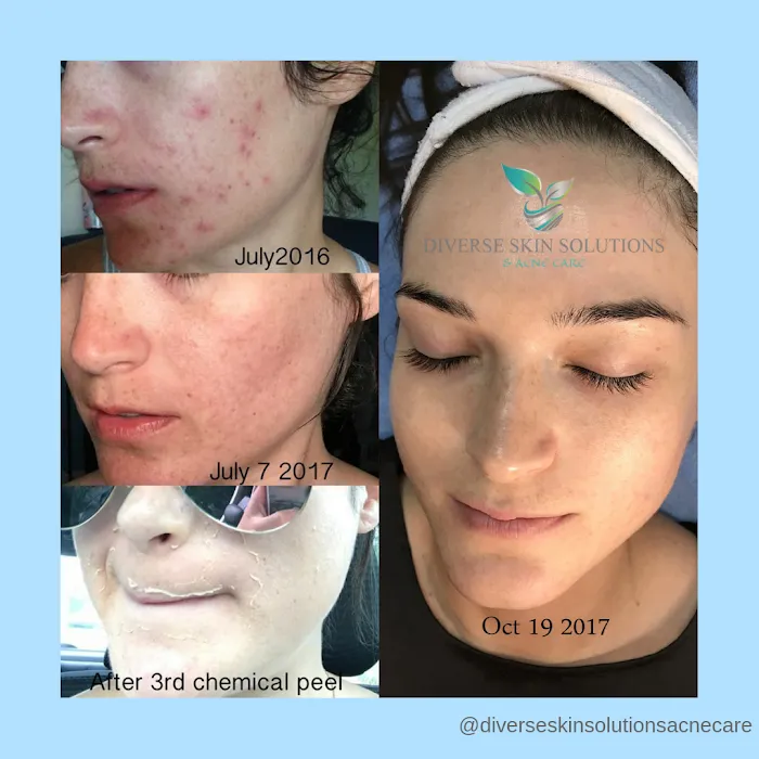Diverse Skin Solutions & Acne Care Picture 8
