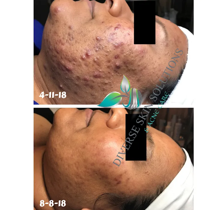 Diverse Skin Solutions & Acne Care Picture 1