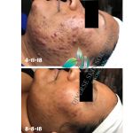 Diverse Skin Solutions & Acne Care