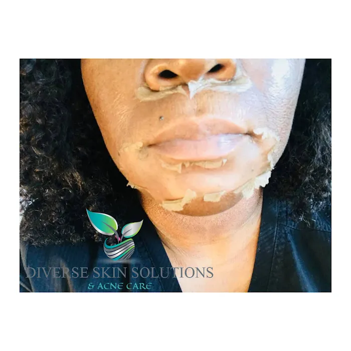 Diverse Skin Solutions & Acne Care Picture 6
