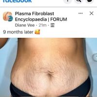 B the Best Beauty Salon ico