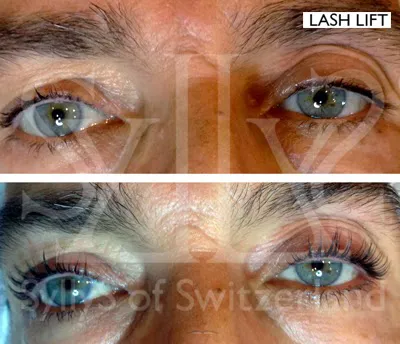 Syllys of Switzerland Picture 6