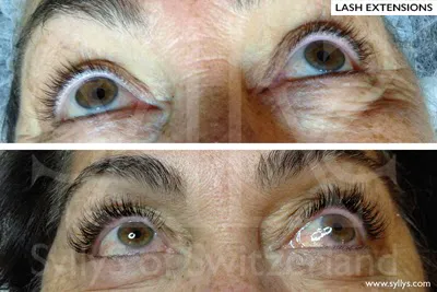 Syllys of Switzerland Picture 2