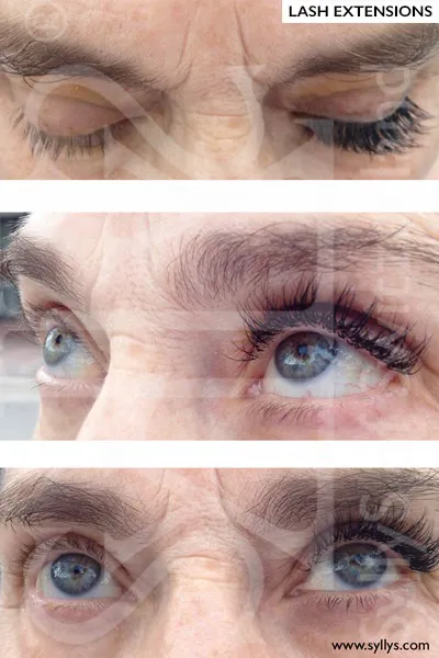 Syllys of Switzerland Picture 5