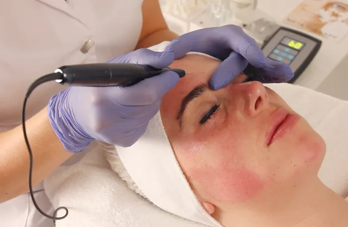 Syllys of Switzerland Picture 8