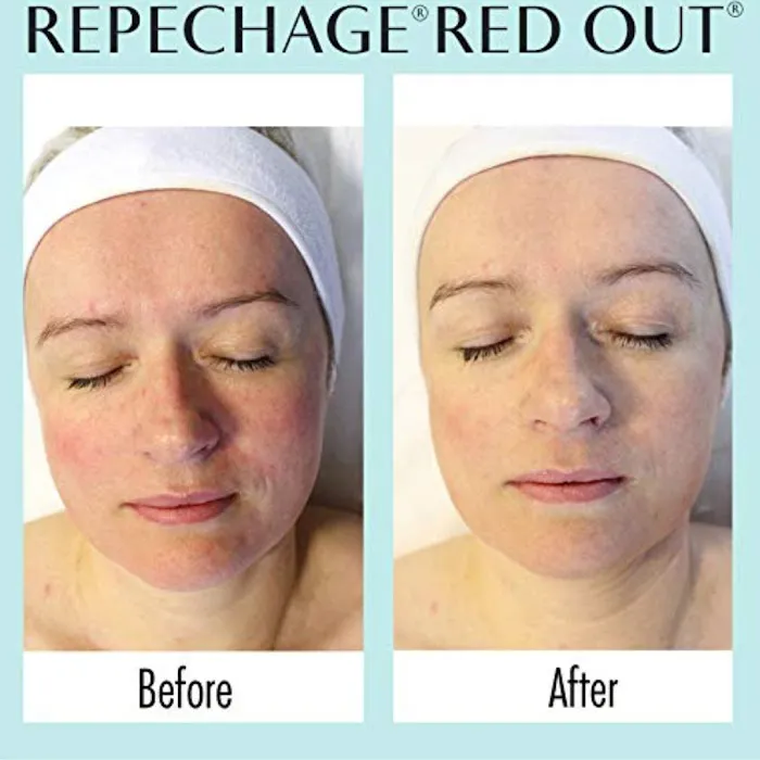 Beverlee Botanicals -a Holistic Skin Studio Picture 6