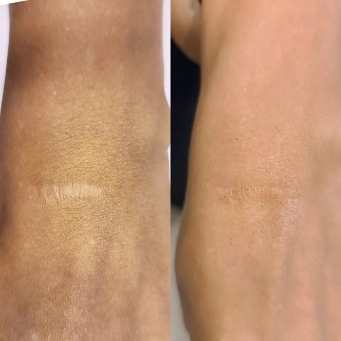 Glowing Young Picture 3