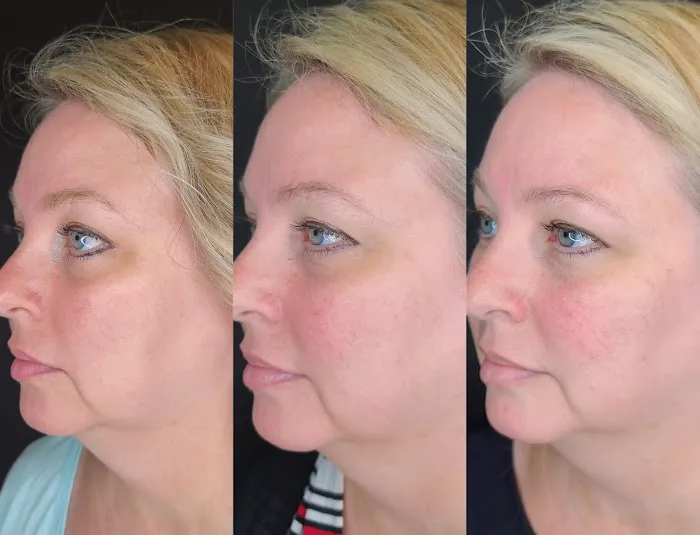 Glowing Young Picture 2