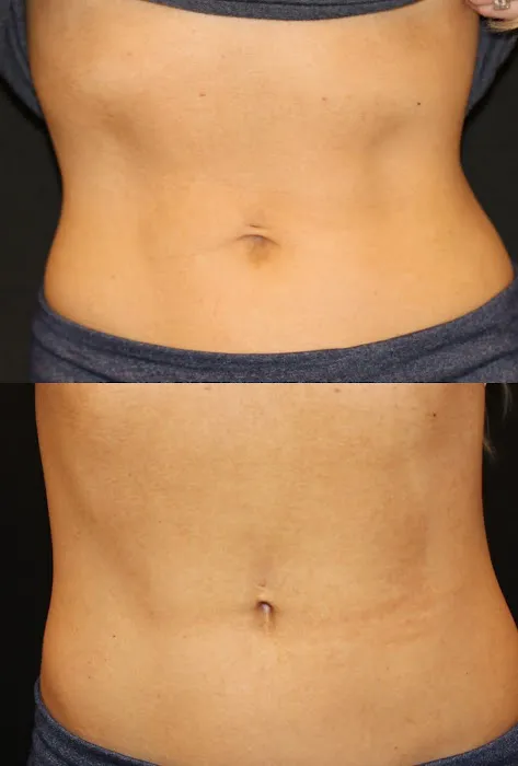 Glowing Young Picture 1