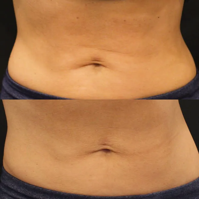 Glowing Young Picture 4