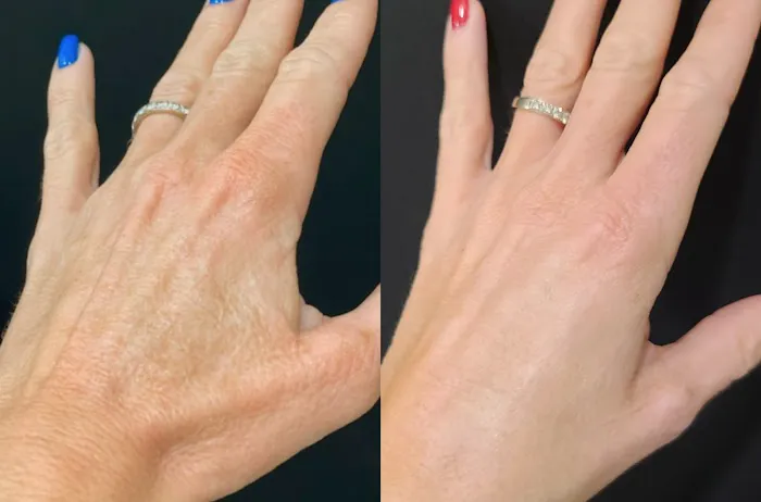 Glowing Young Picture 8