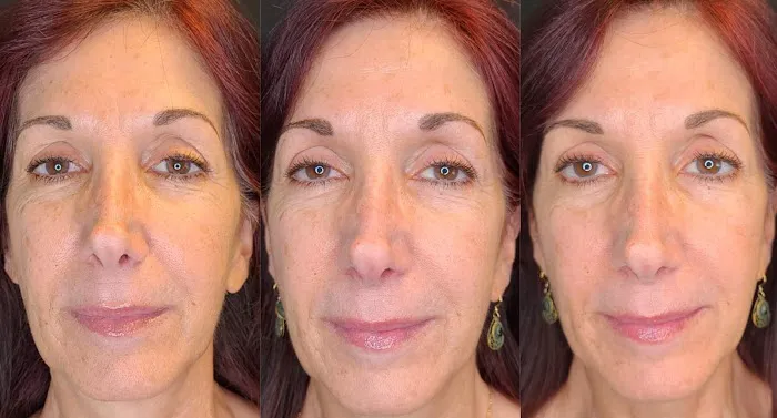 Glowing Young Picture 9