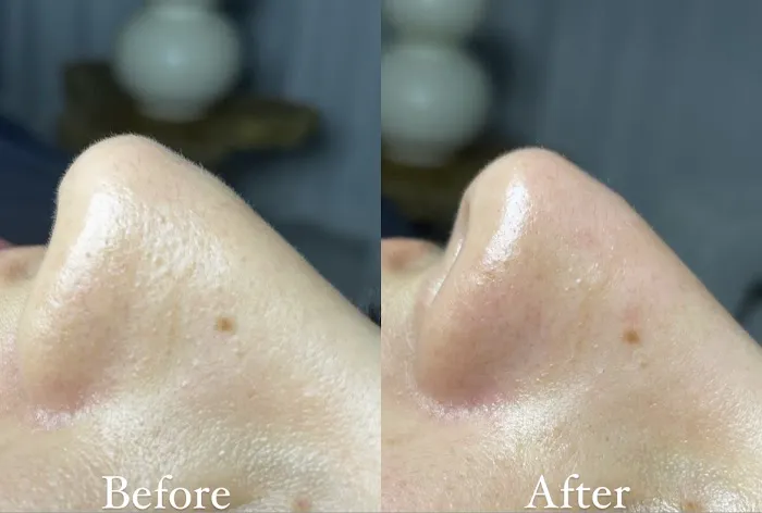 Bare Skin by Nat Picture 4