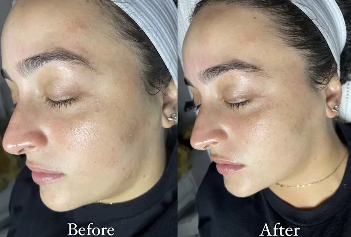 Bare Skin by Nat Picture 7