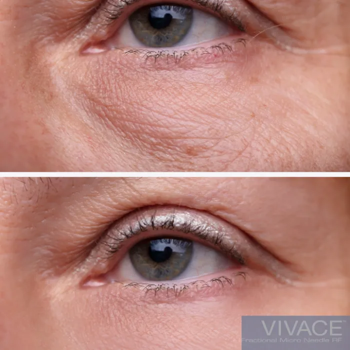 Laser Aesthetic Solutions Picture 7