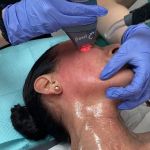 Laser Aesthetic Solutions