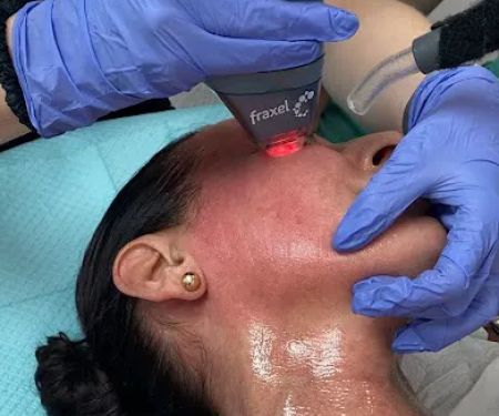 Laser Aesthetic Solutions